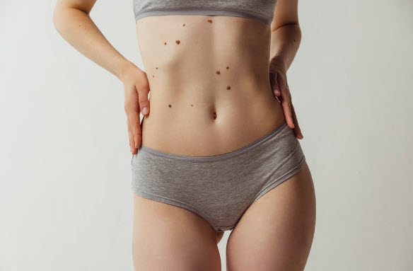xem bói nốt ruồi trên cơ thể phụ nữ