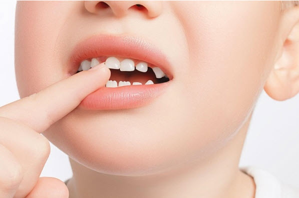 nằm mơ bị gãy răng