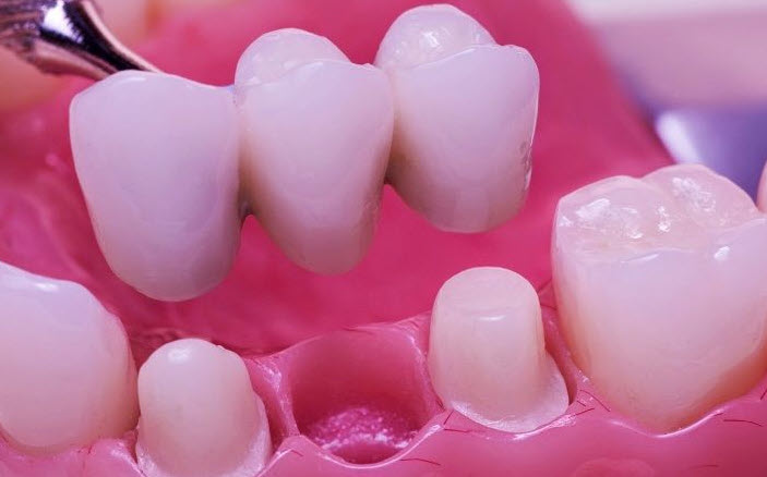 nằm mơ thấy gãy răng không chảy máu